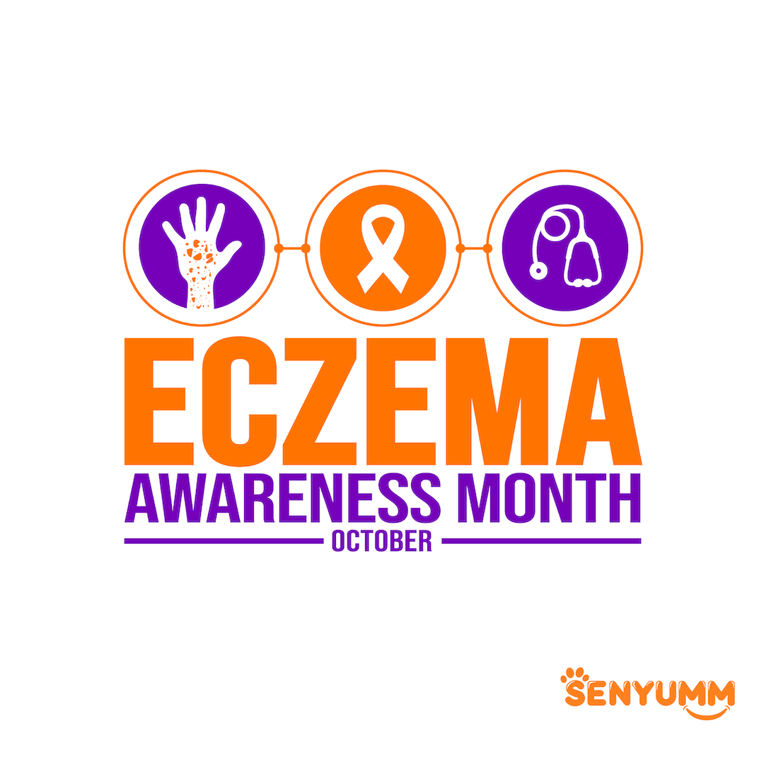 SENYUMM Laundry Detergent Sheets: A Game-Changer for Eczema Sufferers